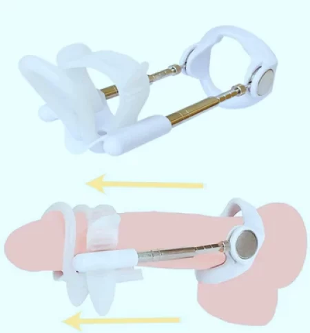 Penis Extender Traction Device - thegaydolls.com