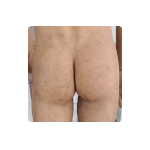 Butt Hair $ Butt Hair $