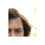 Implanted Hair $$ Implanted Hair